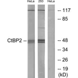 Western Blot - Anti-CtBP2 Antibody (C10751) - Antibodies.com