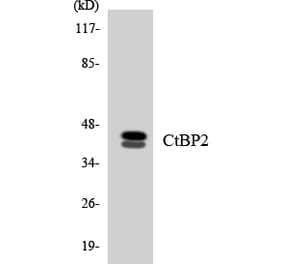 Western Blot - Anti-CtBP2 Antibody (R12-2659) - Antibodies.com