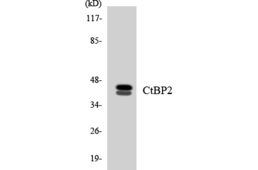 Western Blot - Anti-CtBP2 Antibody (R12-2659) - Antibodies.com