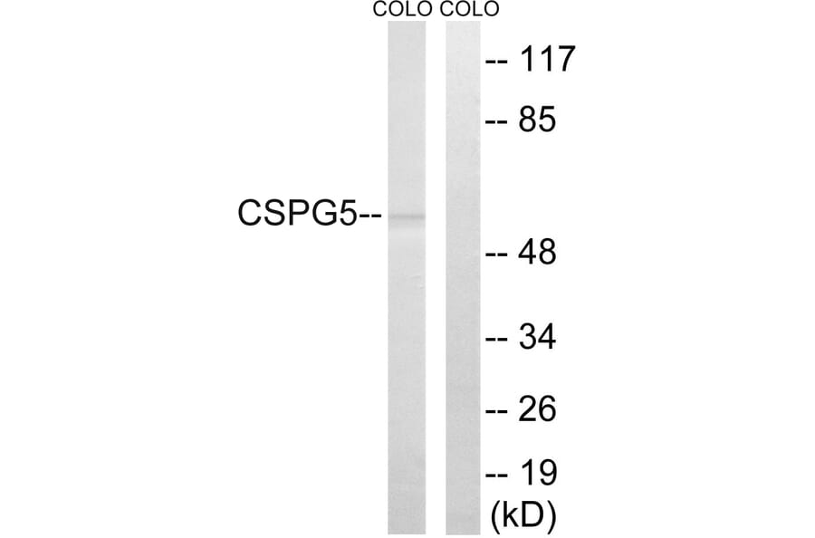 Western Blot - Anti-CSPG5 Antibody (C15097) - Antibodies.com