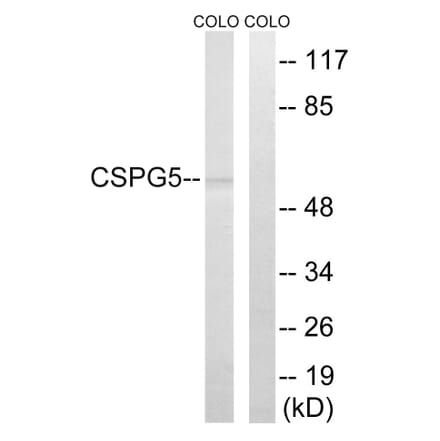 Western Blot - Anti-CSPG5 Antibody (C15097) - Antibodies.com