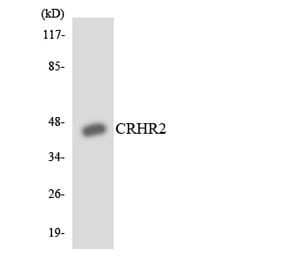 Western Blot - Anti-CRHR2 Antibody (R12-2656) - Antibodies.com