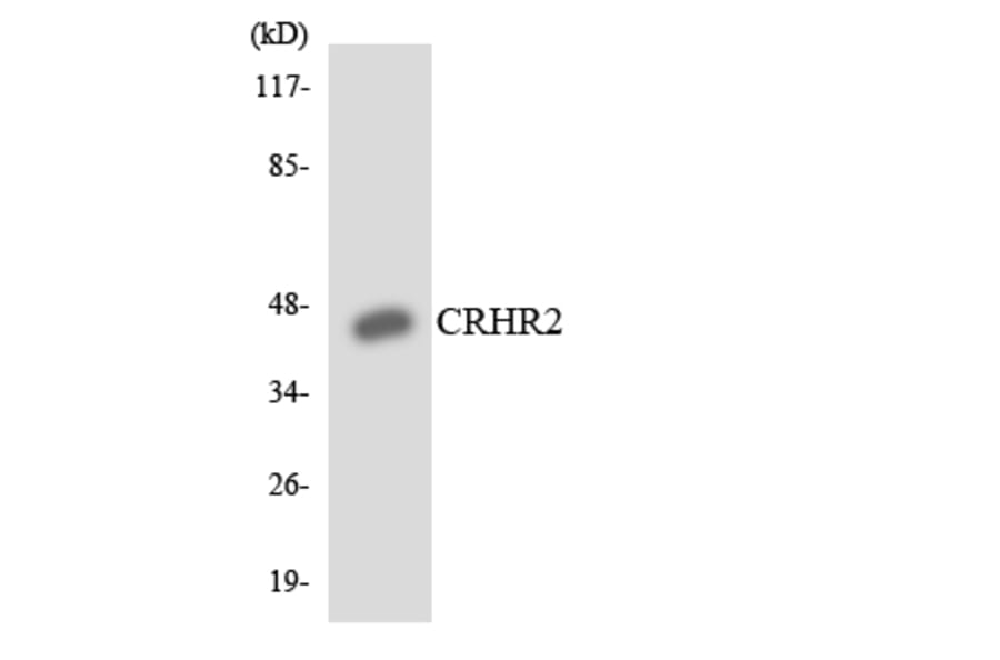Western Blot - Anti-CRHR2 Antibody (R12-2656) - Antibodies.com