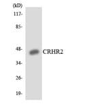 Western Blot - Anti-CRHR2 Antibody (R12-2656) - Antibodies.com