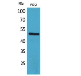 Western Blot - Anti-CRHR1 Antibody (C30982) - Antibodies.com