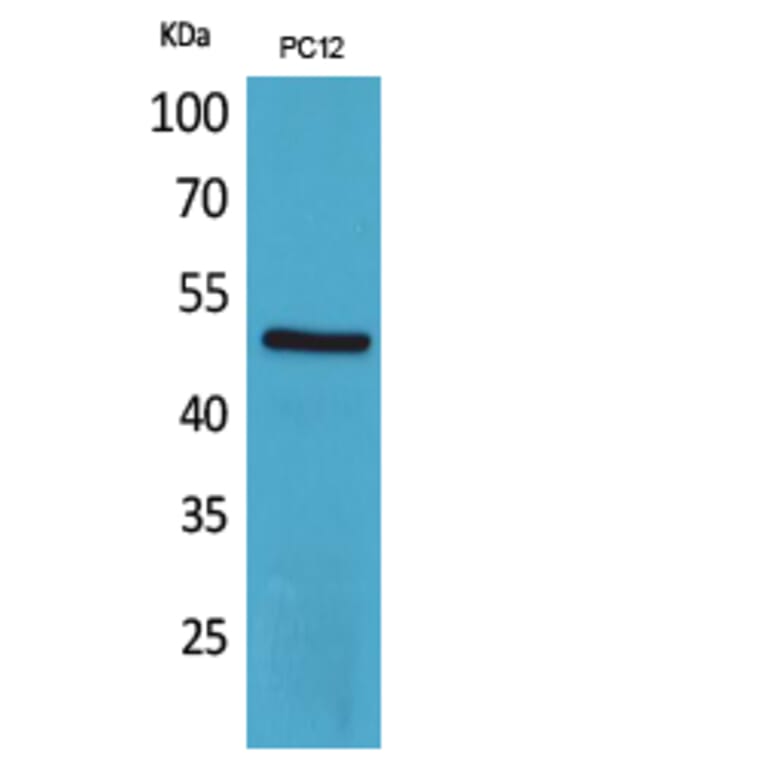 Western Blot - Anti-CRHR1 Antibody (C30982) - Antibodies.com