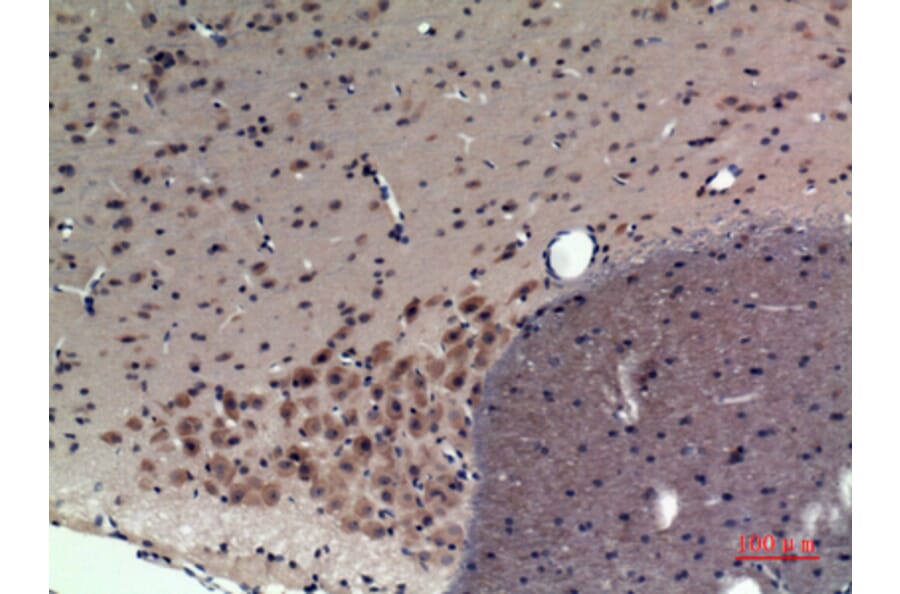 Immunohistochemistry - Anti-CRHR1 Antibody (C30982) - Antibodies.com