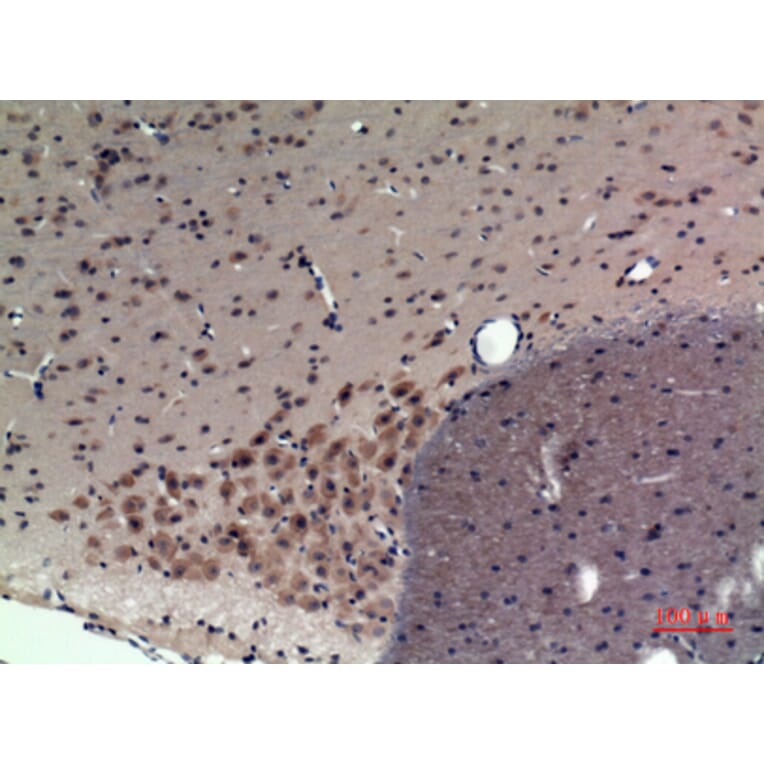 Immunohistochemistry - Anti-CRHR1 Antibody (C30982) - Antibodies.com