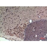 Immunohistochemistry - Anti-CRHR1 Antibody (C30982) - Antibodies.com