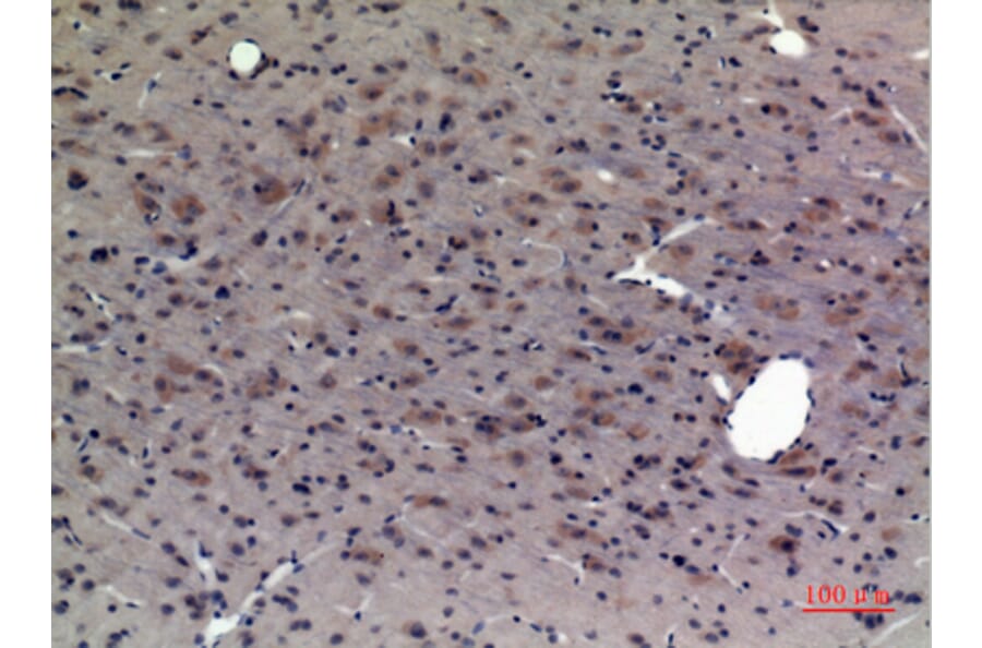 Immunohistochemistry - Anti-CRHR1 Antibody (C30982) - Antibodies.com