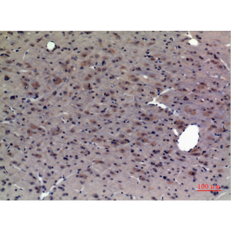 Immunohistochemistry - Anti-CRHR1 Antibody (C30982) - Antibodies.com