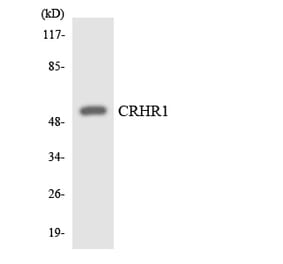 Western Blot - Anti-CRHR1 Antibody (R12-2655) - Antibodies.com