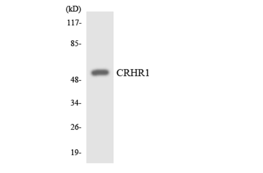 Western Blot - Anti-CRHR1 Antibody (R12-2655) - Antibodies.com