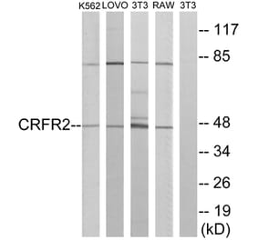 Western Blot - Anti-CRFR2 Antibody (G228) - Antibodies.com