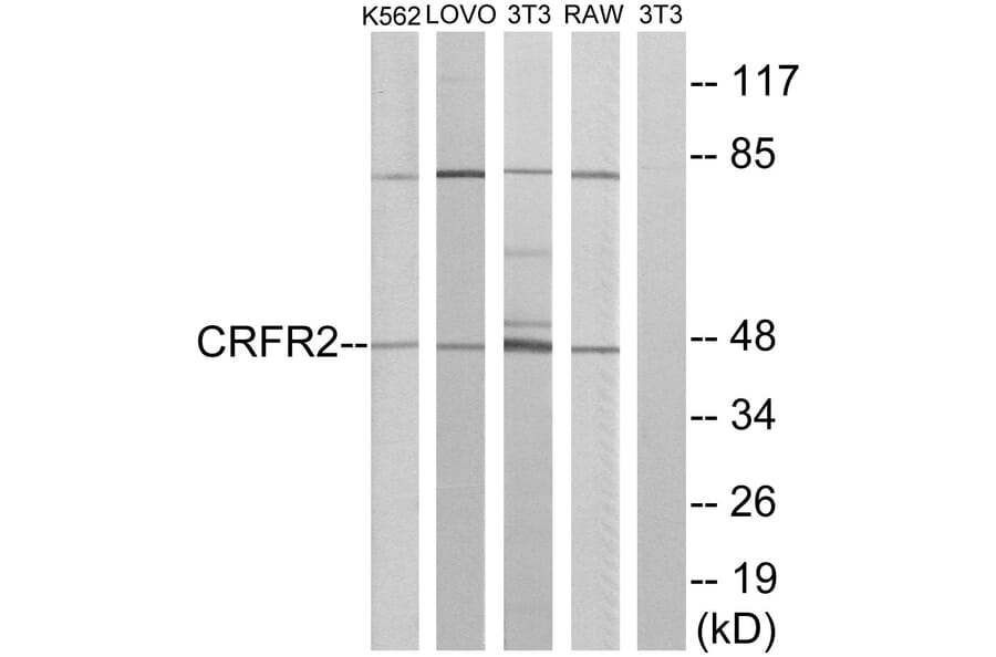 Western Blot - Anti-CRFR2 Antibody (G228) - Antibodies.com