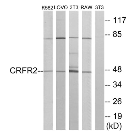 Western Blot - Anti-CRFR2 Antibody (G228) - Antibodies.com