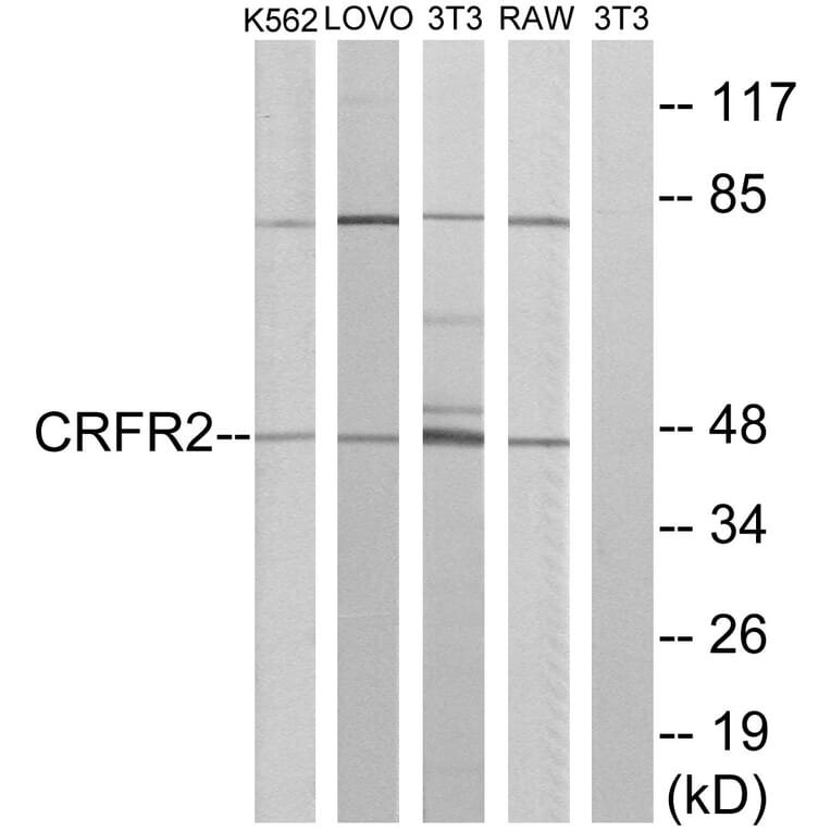 Western Blot - Anti-CRFR2 Antibody (G228) - Antibodies.com