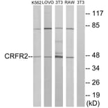 Western Blot - Anti-CRFR2 Antibody (G228) - Antibodies.com