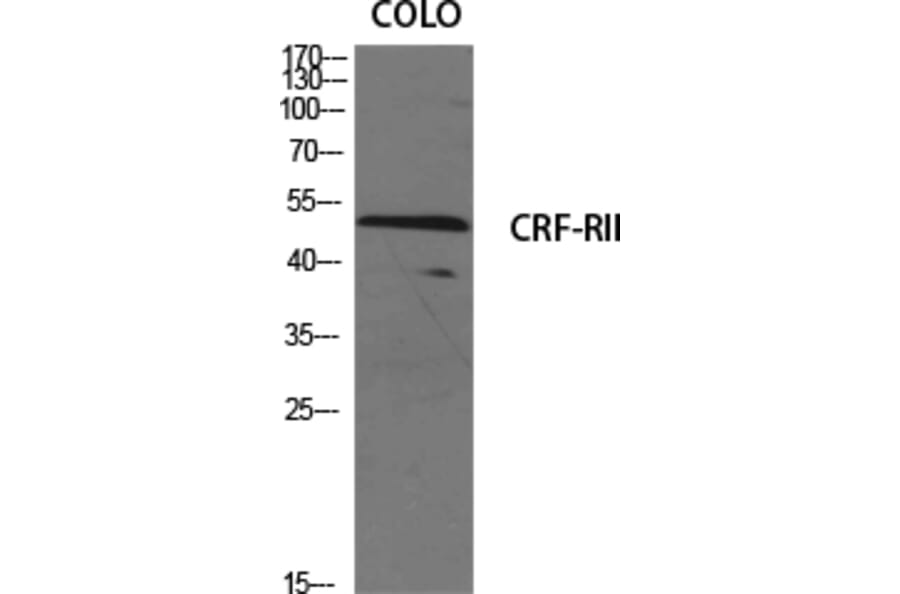 Western Blot - Anti-CRFR2 Antibody (G228) - Antibodies.com