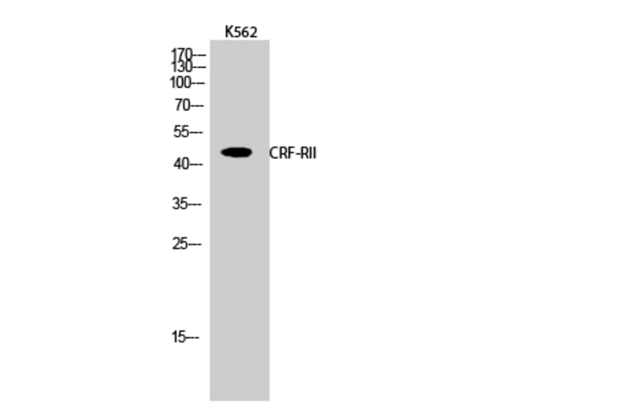 Western Blot - Anti-CRFR2 Antibody (G228) - Antibodies.com