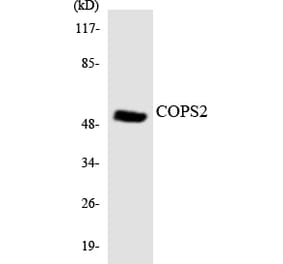 Western Blot - Anti-COPS2 Antibody (R12-2644) - Antibodies.com