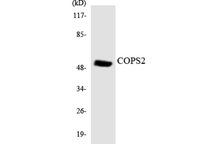 Western Blot - Anti-COPS2 Antibody (R12-2644) - Antibodies.com