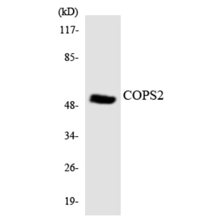 Western Blot - Anti-COPS2 Antibody (R12-2644) - Antibodies.com