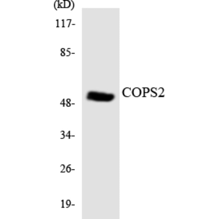Western Blot - Anti-COPS2 Antibody (R12-2644) - Antibodies.com