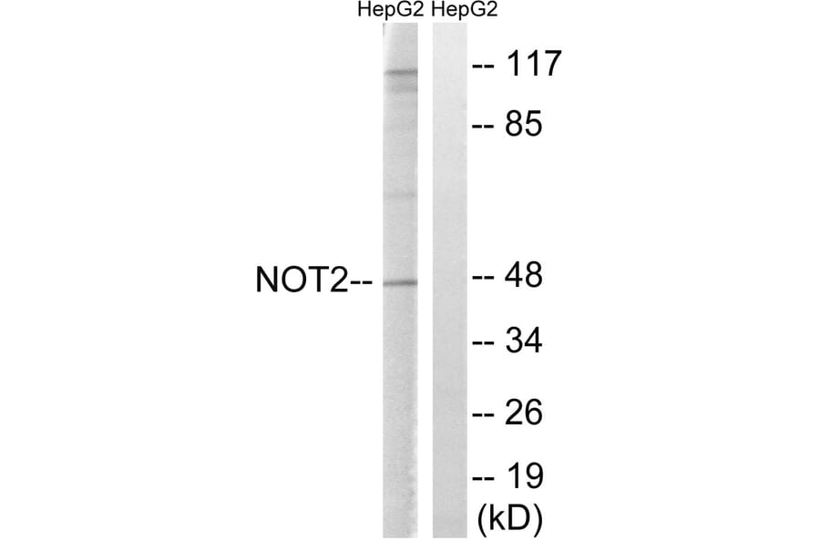 Western Blot - Anti-CNOT2 Antibody (B8387) - Antibodies.com