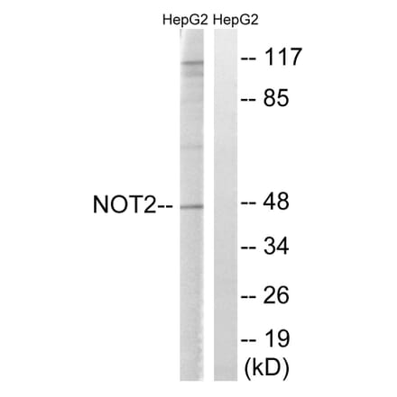 Western Blot - Anti-CNOT2 Antibody (B8387) - Antibodies.com