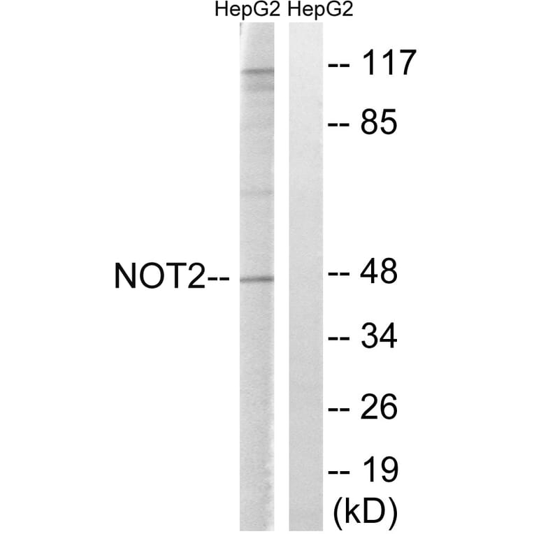 Western Blot - Anti-CNOT2 Antibody (B8387) - Antibodies.com