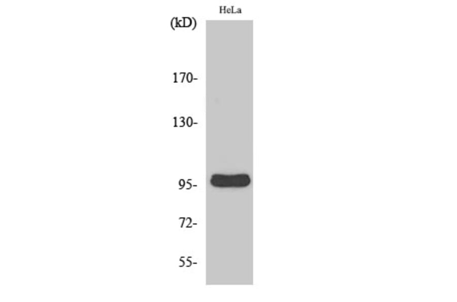 Western Blot - Anti-CNNM2 Antibody (C20929) - Antibodies.com