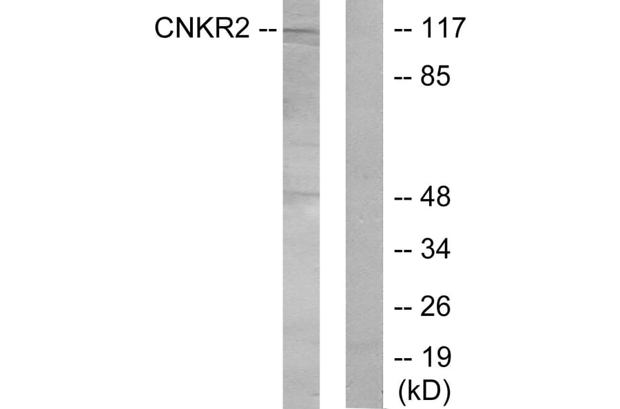 Western Blot - Anti-CNKR2 Antibody (C11415) - Antibodies.com