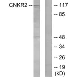 Western Blot - Anti-CNKR2 Antibody (C11415) - Antibodies.com