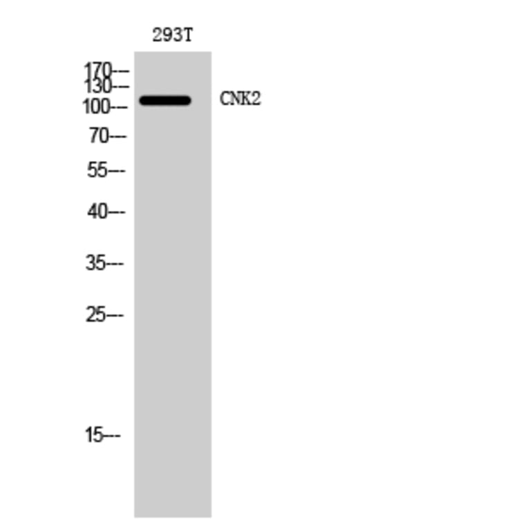 Western Blot - Anti-CNKR2 Antibody (C11415) - Antibodies.com