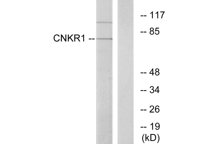 Western Blot - Anti-CNKR1 Antibody (C11460) - Antibodies.com