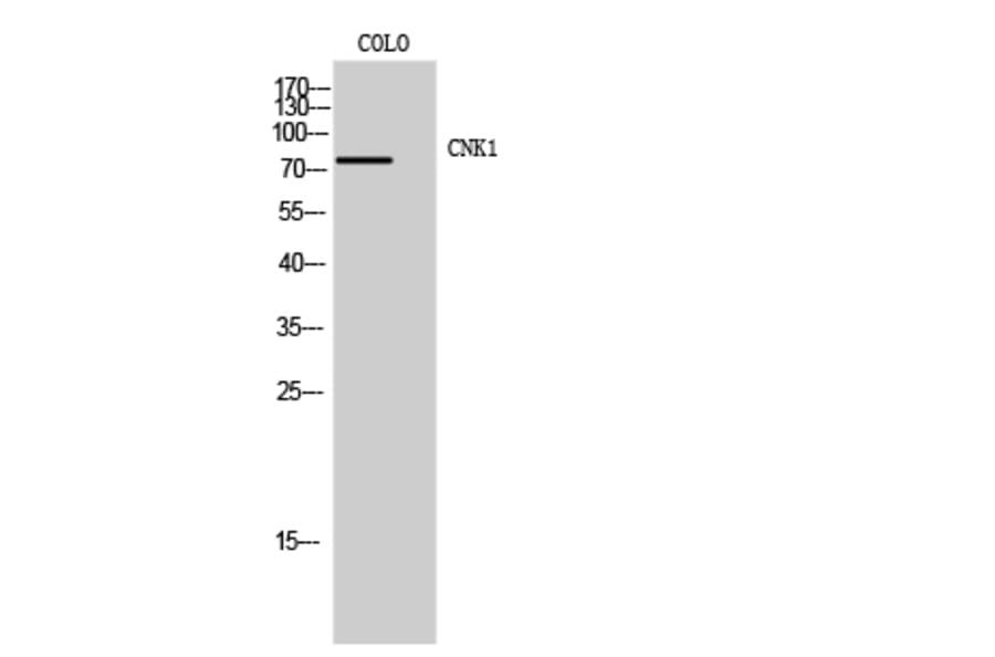 Western Blot - Anti-CNKR1 Antibody (C11460) - Antibodies.com