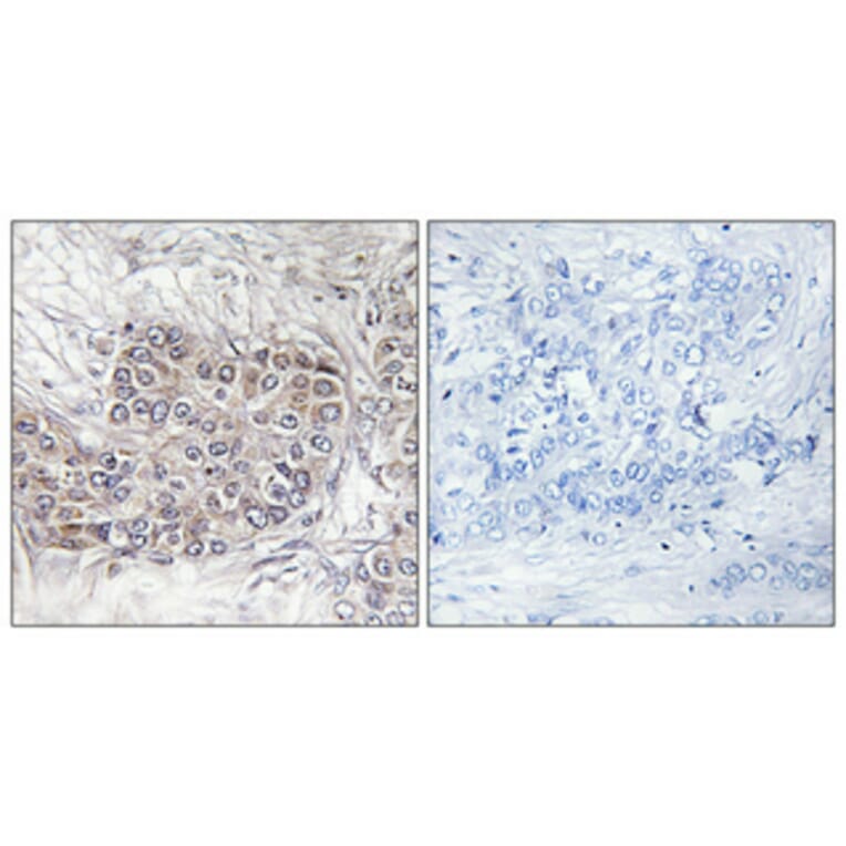 Immunohistochemistry - Anti-CNKR1 Antibody (C11460) - Antibodies.com