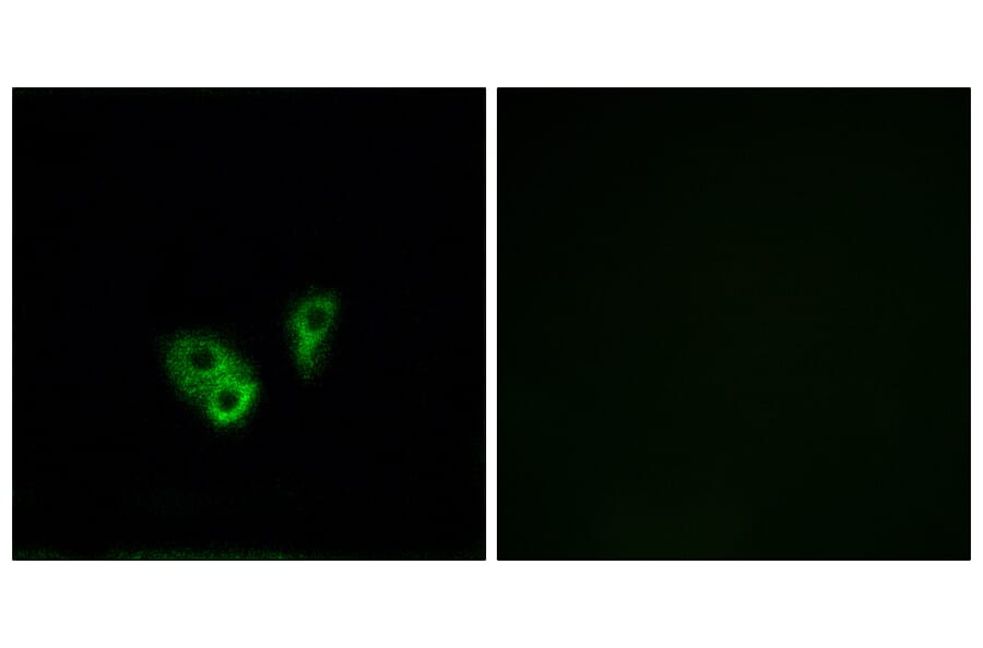 Immunofluorescence - Anti-CNGA2 Antibody (C15268) - Antibodies.com