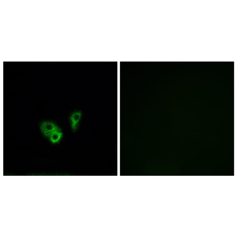 Immunofluorescence - Anti-CNGA2 Antibody (C15268) - Antibodies.com