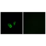 Immunofluorescence - Anti-CNGA2 Antibody (C15268) - Antibodies.com