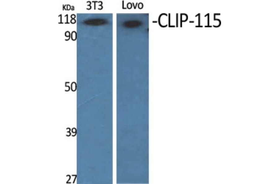 Western Blot - Anti-CLIP2 Antibody (C14916) - Antibodies.com