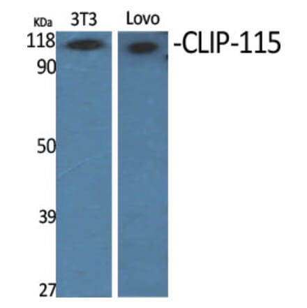 Western Blot - Anti-CLIP2 Antibody (C14916) - Antibodies.com