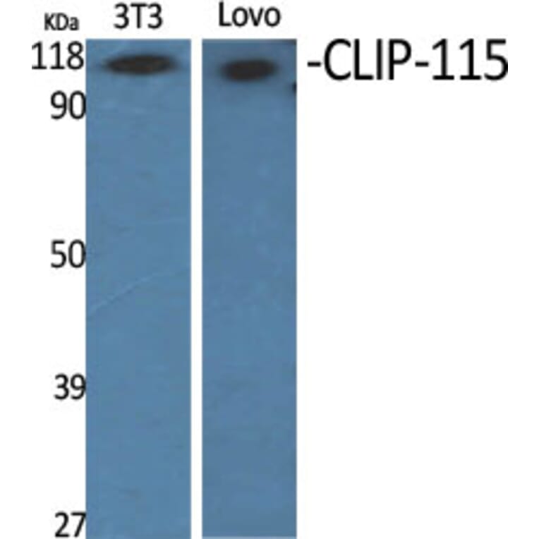 Western Blot - Anti-CLIP2 Antibody (C14916) - Antibodies.com