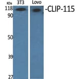 Western Blot - Anti-CLIP2 Antibody (C14916) - Antibodies.com