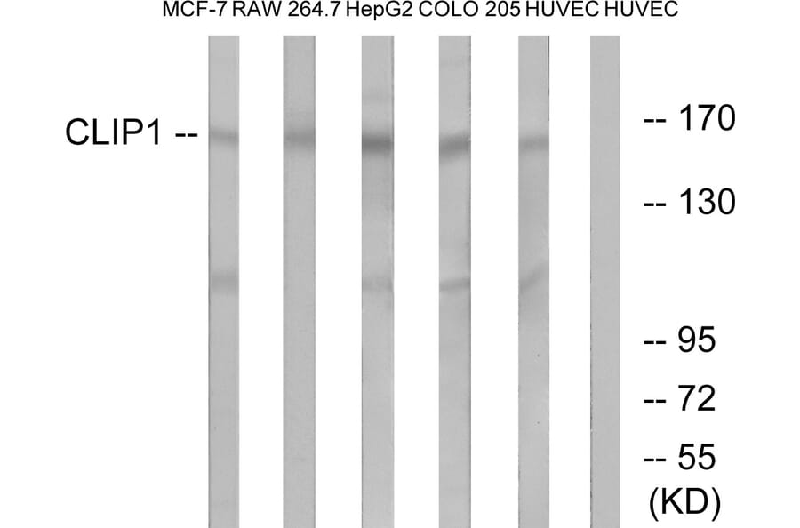 Western Blot - Anti-CLIP1 Antibody (C14915) - Antibodies.com