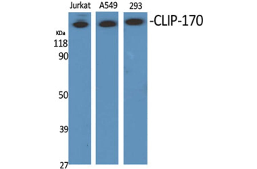 Western Blot - Anti-CLIP1 Antibody (C14915) - Antibodies.com