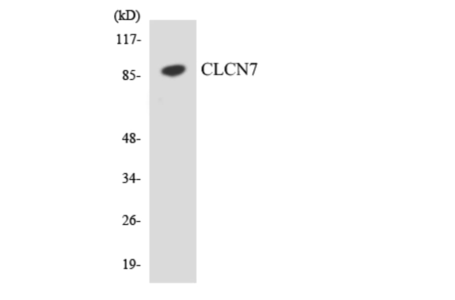 Western Blot - Anti-CLCN7 Antibody (R12-2625) - Antibodies.com