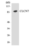 Western Blot - Anti-CLCN7 Antibody (R12-2625) - Antibodies.com