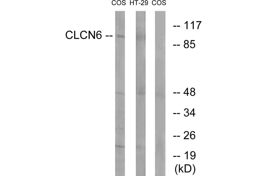 Western Blot - Anti-CLCN6 Antibody (C15081) - Antibodies.com